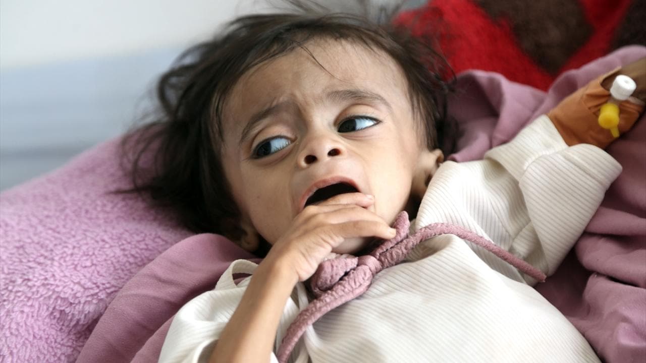 Yemen’de çatışmalar yerinden edilmeyi ve insani ihtiyaçları artırdı